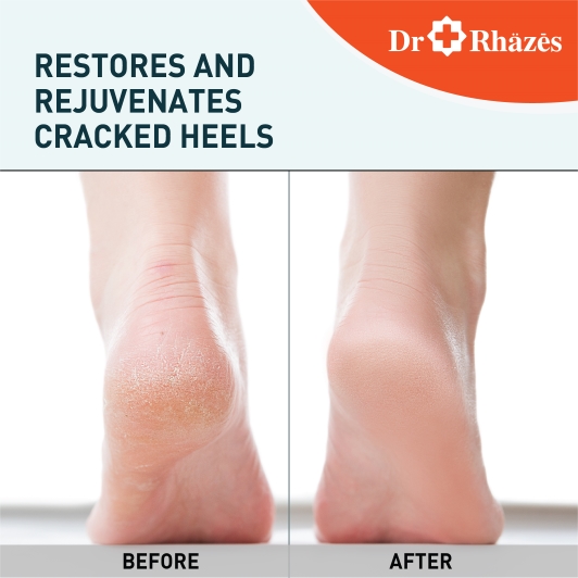 Dr Rhazes  foot care cream
